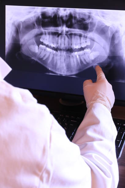 Best Emergency Root Canal Treatment in Summerfield, NC